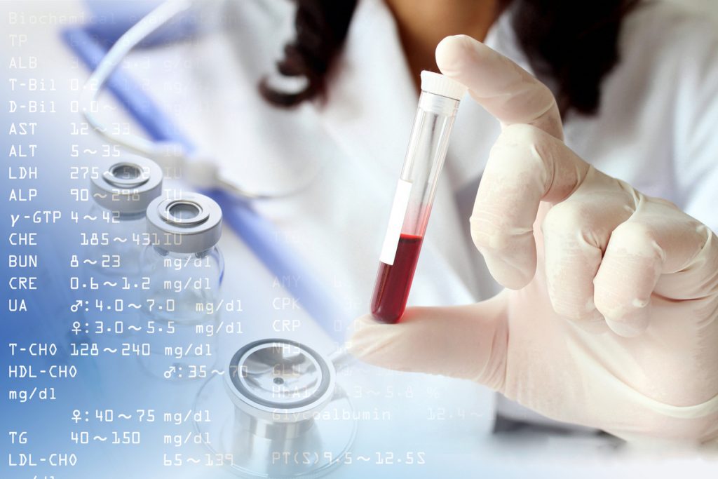 test no invasivo en sangre materna
