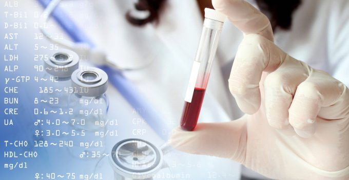 test no invasivo en sangre materna
