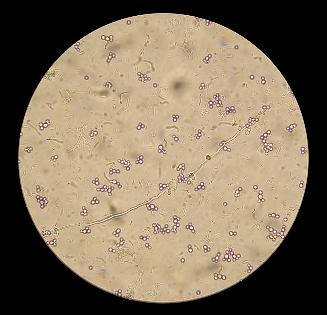 Грибы кандида микроскопия